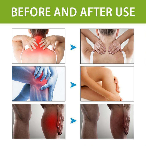 Bee Venom Ultra Strength Pain Relief Cream 100 gram (Buy 1 Get 1 Free)